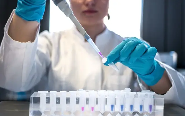 Laboratory researcher using a pipette to analyze samples in test tubes, illustrating scientific research on the connection between chronic stress, cortisol, and testosterone levels.